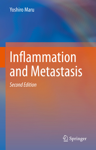 Inflammation and Metastasis