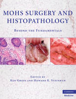 Mohs Surgery and Histopathology