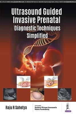 Ultrasound Guided Invasive Prenatal Diagnostic Techniques Simplified - Raju R Sahetya