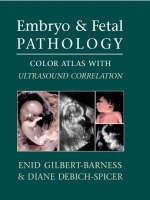 Embryo and Fetal Pathology