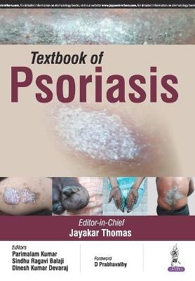 Textbook of Psoriasis - Jayakar Thomas