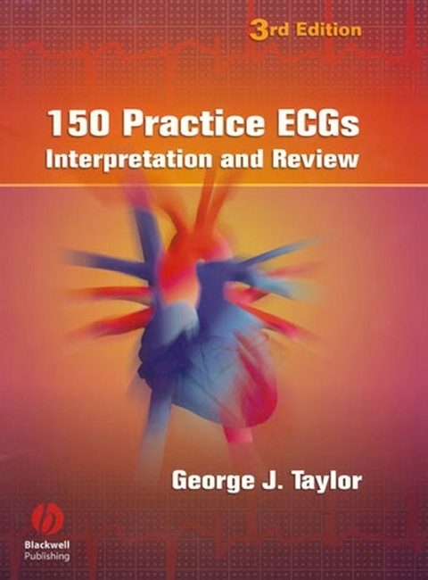 150 Practice ECGs - George J. Taylor