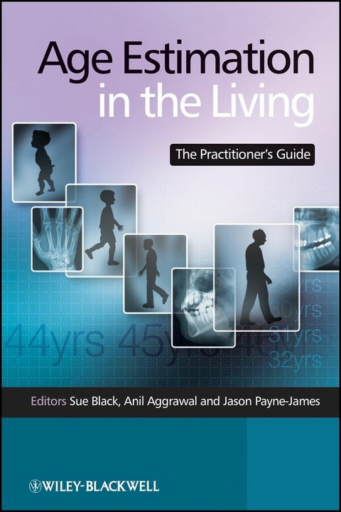 Age Estimation in the Living - 