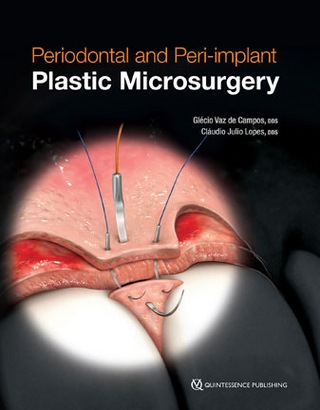 Periodontal and Peri-Implant Microsurgery