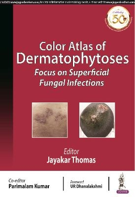 Color Atlas of Dermatophytoses