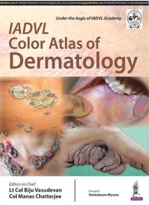 IADVL Color Atlas of Dermatology - Biju Vasudevan, Manas Chatterjee