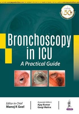 Bronchoscopy in ICU: A Practical Guide