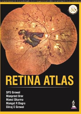 Retina Atlas - SPS Grewal, Manpreet Brar, Mansi Sharma, Mangat R Dogra, Dilraj S Grewal