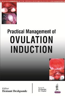 Practical Management of Ovulation Induction