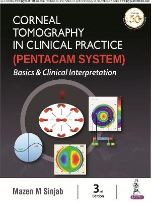 Corneal Tomography in Clinical Practice (Pentacam System)