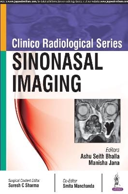 Clinico Radiological Series: Sinonasal Imaging - Ashu Seith Bhalla, Manisha Jana