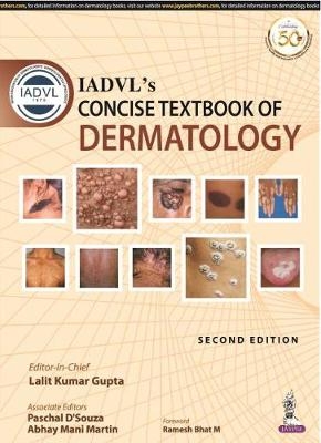 IADVL's Concise Textbook of Dermatology - Lalit Kumar Gupta, Paschal D'Souza, Abhay Mani Martin
