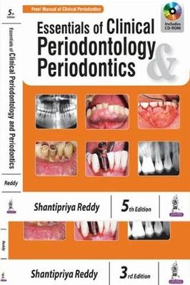 Essentials of Clinical Periodontology & Periodontics