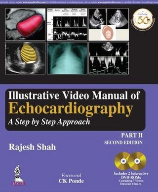 Illustrative Video Manual of Echocardiography