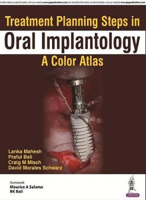 Treatment Planning Steps in Oral Implantology