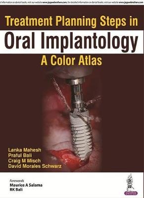 Treatment Planning Steps in Oral Implantology - Lanka Mahesh, Praful Bali, Craig M Misch, David Morales Schwarz