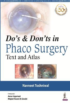 Do's & Dont's in Phaco Surgery - Navneet Toshniwal