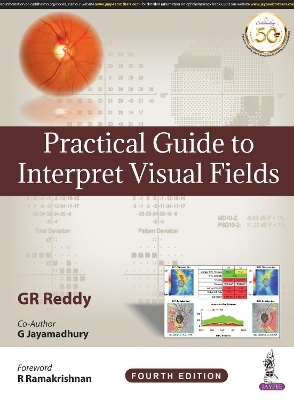 Practical Guide to Interpret Visual Fields
