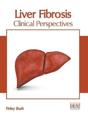 Liver Fibrosis: Clinical Perspectives