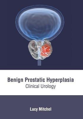 Benign Prostatic Hyperplasia: Clinical Urology