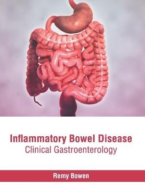 Inflammatory Bowel Disease: Clinical Gastroenterology