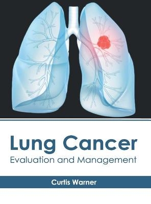Lung Cancer: Evaluation and Management