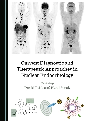 Current Diagnostic and Therapeutic Approaches in Nuclear Endocrinology - 