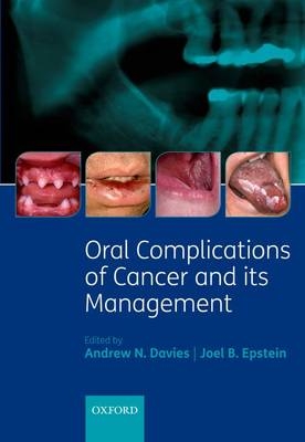 Oral Complications of Cancer and its Management