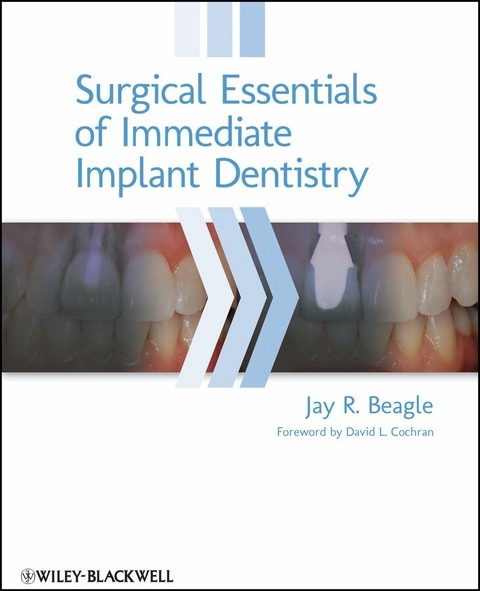 Surgical Essentials of Immediate Implant Dentistry - Jay R. Beagle