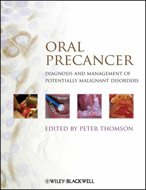 Oral Precancer - 