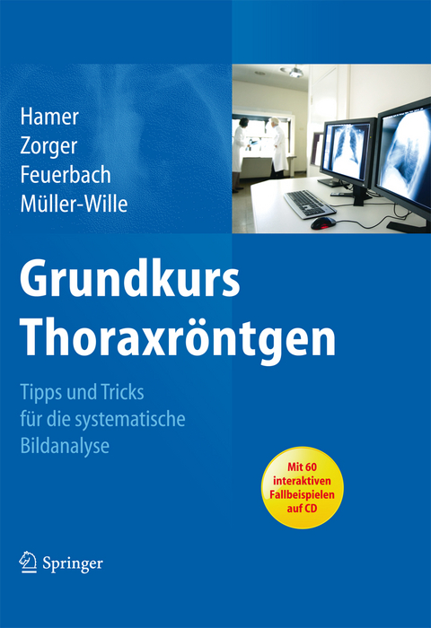 Grundkurs Thoraxröntgen -  Okka Hamer,  Niels Zorger,  Stefan Feuerbach,  René Müller-Wille