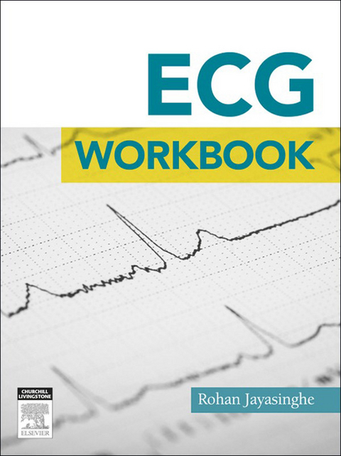 ECG workbook - E-Book -  Rohan Jayasinghe