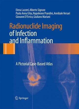 Radionuclide Imaging of Infection and Inflammation