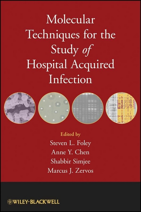 Molecular Techniques for the Study of Hospital Acquired Infection - 