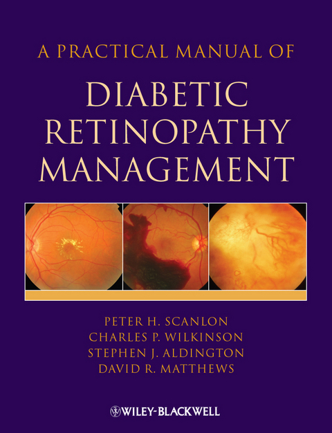 A Practical Manual of Diabetic Retinopathy Management - Peter H. Scanlon, Stephen Aldington, Charles Wilkinson, David Matthews