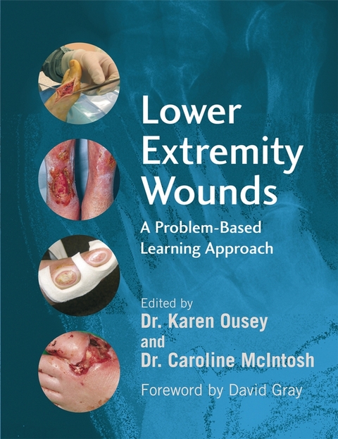 Lower Extremity Wounds - 