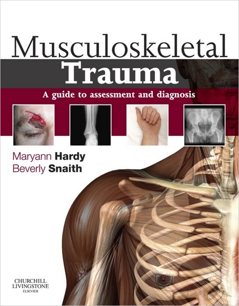 Musculoskeletal Trauma E-Book - 