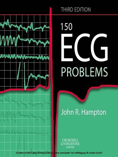 150 ECG Problems -  John R. Hampton