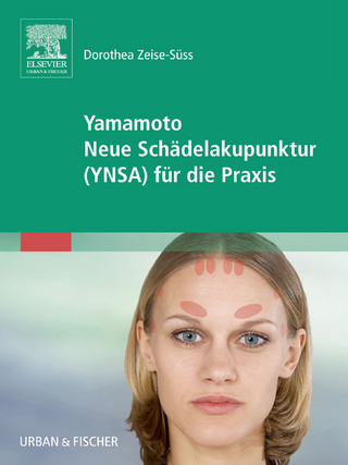 Yamamoto Neue Schädelakupunktur (YNSA)