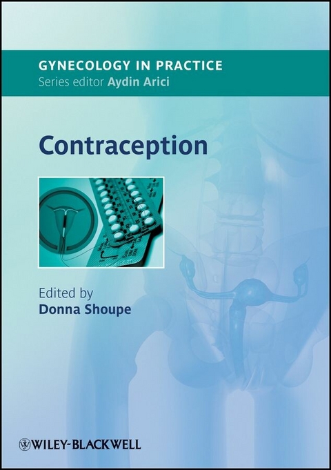 Contraception - 