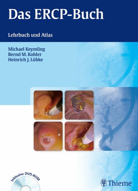 Das ERCP-Buch - Michael Keymling, Bernd M. Kohler, Heinrich-J. L&uuml;bke