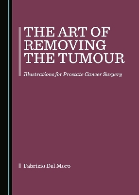 The Art of Removing the Tumour