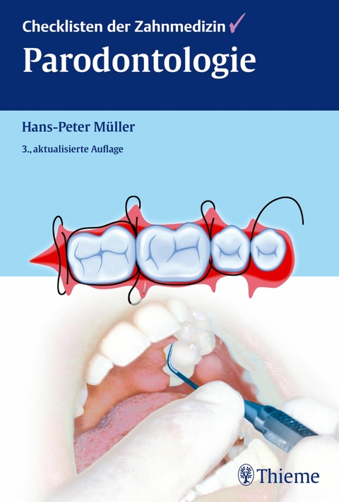 Checklisten der Zahnmedizin Parodontologie -  Hans-Peter M&uuml;ller