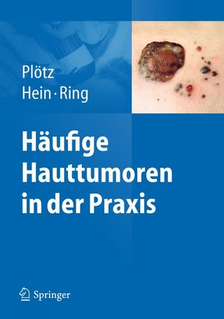 Häufige Hauttumoren in der Praxis