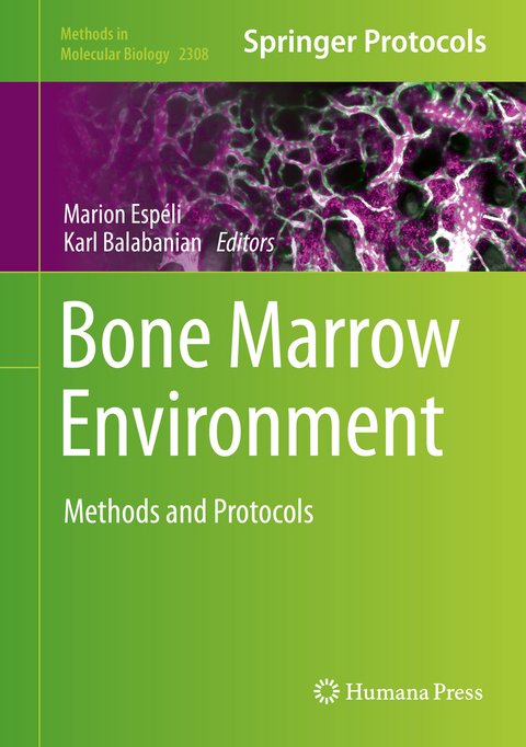 Bone Marrow Environment - 