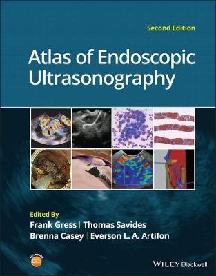 Atlas of Endoscopic Ultrasonography - 