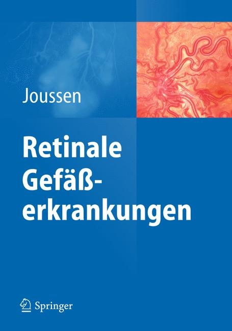 Retinale Gef&auml;&szlig;erkrankungen - 