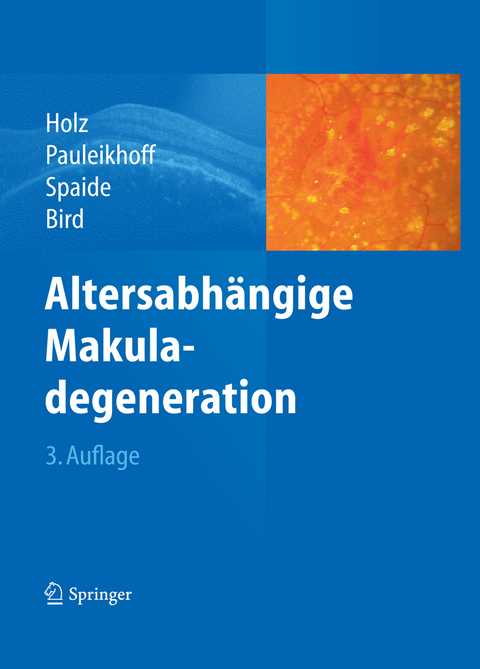 Altersabh&auml;ngige Makuladegeneration - 