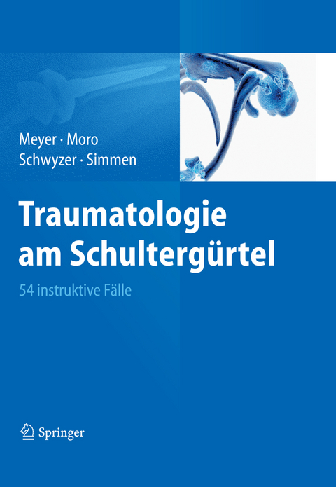 Traumatologie am Schulterg&uuml;rtel - Rainer-Peter Meyer, Fabrizio Moro, Hans-Kaspar Schwyzer, Beat Ren&eacute; Simmen