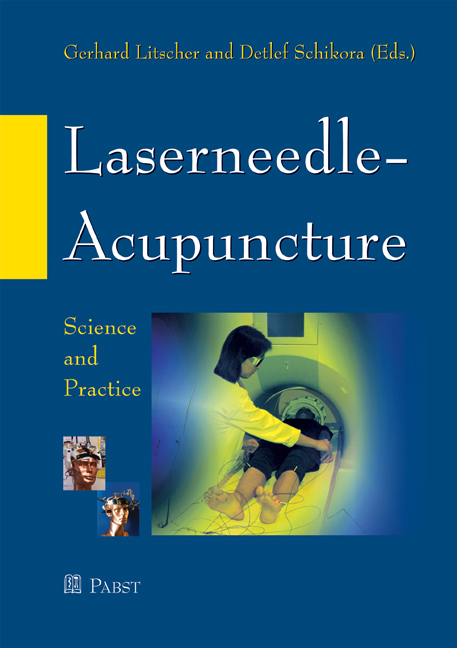 Laserneedle-Acupuncture - 